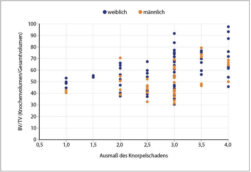 Pathogenese der Gonarthrose Subchondrale Knochenveränderungen schein